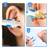 Qgrips Earwax Remover-spiral Ear Wax Removal Tool, Reusable