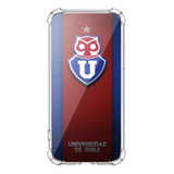 Carcasa Personalizada U De Chile Para  Moto S30 Pro