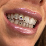 Strass Swarovski Joyeria Dental, Gema Dental, Strass Dental
