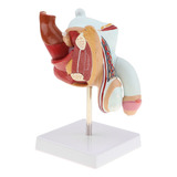 1: 1 Modelo De Anatomía Sistema Urinario Patológico