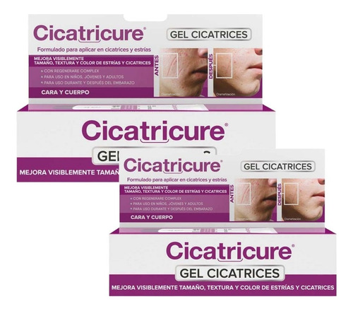 Pack Cicatricure Gel Cicatrices Y Estrías 60 + 30 Gramos