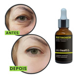Creme Gel Área Olhos Inchaço Efeito Botox Olheiras Retinonew
