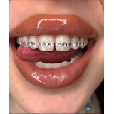 Strass Dental Cuadrado Swarovski X 6 Gema Dental 