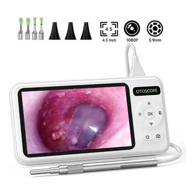Otoscopio Digital Monitor Hd Incluye Conos Y Cucharillas 5  | Meses sin interés