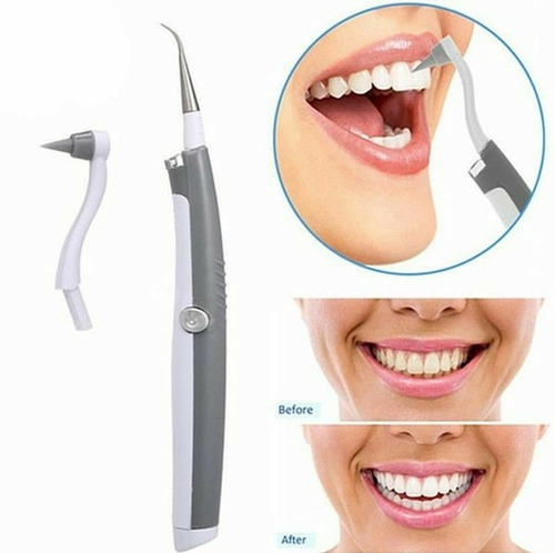 Removedor Ultrasonico De Sarro Dental A Pila Novedad