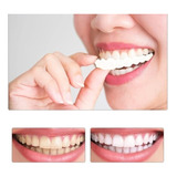 Dentadura Removivel Snap On Smile ( Par )