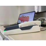 Scanner Intraoral