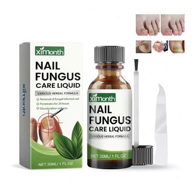 Líquido Para Hongos En Uñas - Cura Hongos Y Onicomicosis | MercadoLibre