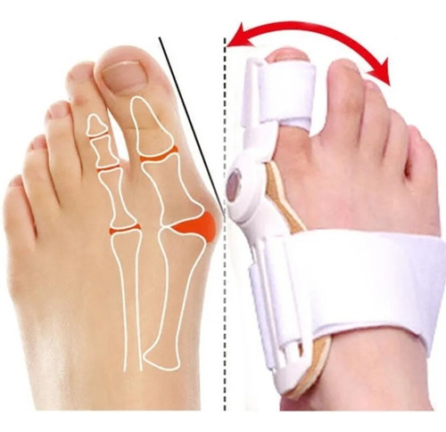 Ferula Corrector De Juanetes Hallux Valgus Ortesis Jca