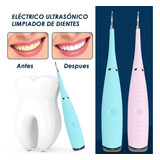 Limpiador De Dientes Electrico 3en1 Removedor Sarro Cepillo