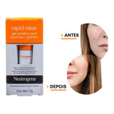 Gel Secativo Para Espinhas Neutrogena 15g