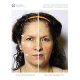 Galvánica Facial De Nuskin