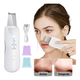 Limpiador Facial Peeling Ultrasonico Portátil Skin Scrubber