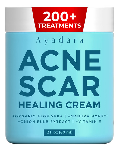 Ayadara Crema Curativa Para Cicatrices De Acne | Crema Facia