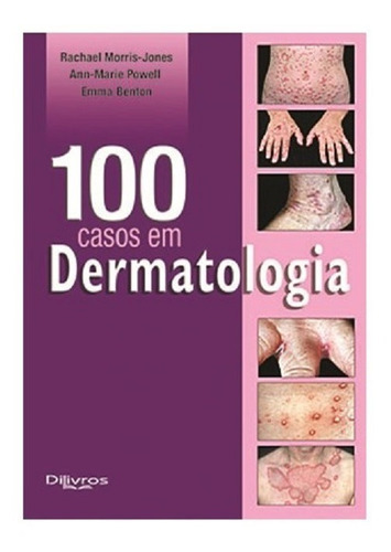 100 Casos Em Dermatologia, De Rachel Morris-jones. Editora Dilivros, Capa Mole Em Português, 2013