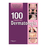 100 Casos Em Dermatologia, De Rachel Morris-jones. Editora Dilivros, Capa Mole Em Português, 2013