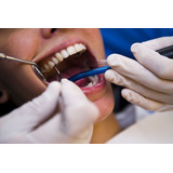 Limpieza Dental - Profilaxis Dental Ambos Maxilares