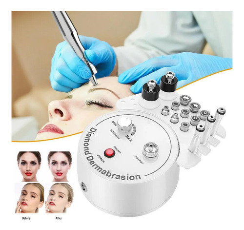 Diamond Peeling Limpieza Facial Microdermoabrasion 3 En 1