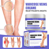 L Crema De Reparación De Venas Varicosas Venas Eliminadas Y