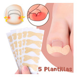 Corrector De Uñas Encarnadas Adhesivo Alisar El Dolor 5pz F