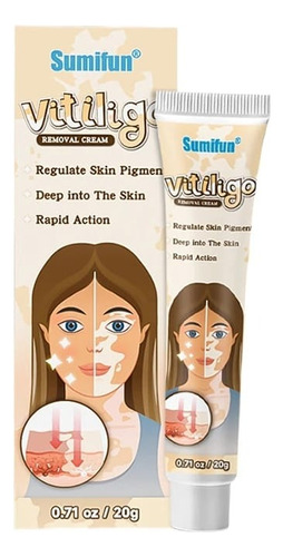 Crema Para Vitiligo Herbal - g a $1225