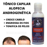 Tratamento Capilar Cura Calvície Tônico Anti Alopecia Areata