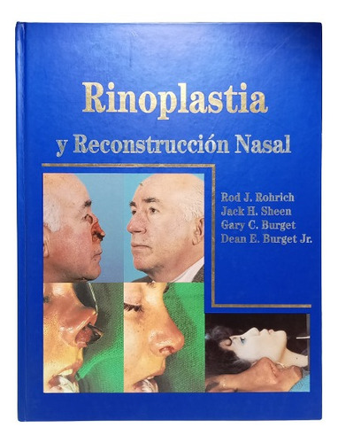 Rinoplastia - Rod Rohrich - Quality Medical Publishing  2000
