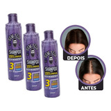 Dom Pelo Shampoo Nixidil Kit  Com 3 Unidades 250 Ml Cada