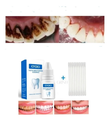 Clareador De Dentes- Tira Manchas Limpeza Dente- Eficaz!