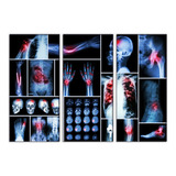 Set De 3 Cuadros Radiografia Partes Del Cuerpo 90x130cm