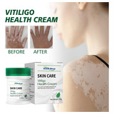 Crema Blanca De Alta Calidad Para Vitíligo, Psoriasis Locali