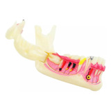 Tipodonto Dental Mandibular Gsciii