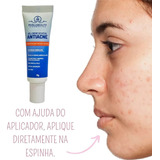 Gel Creme Secativo De Espinhas