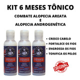 Kit 6 Meses Alopécia Androgenética Nasce Cresce E Fortalece!