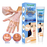 B5 Cuidado De La Piel Adulto Crema Hidratante Vitiligo Cream