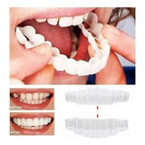 Snap On Smile Superior E Inferior Prótesis Dentadura Postiço