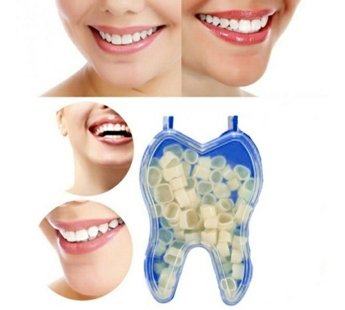 Dentes Molares Amarelados, Postiços,provisórios+massa