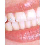 Strass Dental