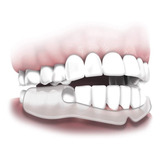 Guarda Dental Plackers Grind No More Dental Night 10 Piezas