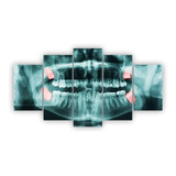 Quadros Decorativos Mfd Raio X Dentes Dentista