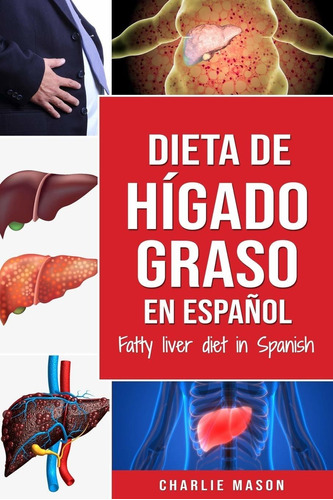 Libro Dieta De Hígado Graso En Español/fatty Liver Di Lsf2