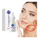 Serum Bioaqua Elimina Pecas Melasma Paño Aclara Piel Manchas