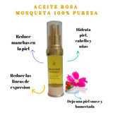 Aceite Rosa Mosqueta 100% Puro, Elimina Manchas Piel 20ml 