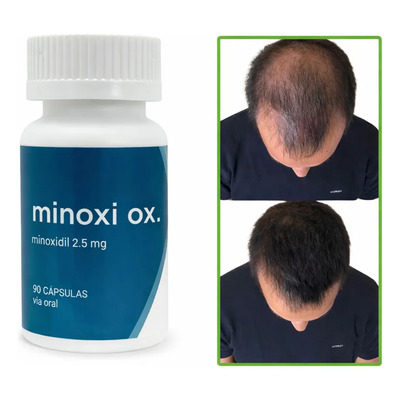 Fórmula Capilar En Cápsulas Con Minoxidil 2.5mg 90 Caps | Meses sin interés