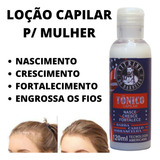 Loção Capilar Tratamento Alopécia Nasce Cresce Cabelo