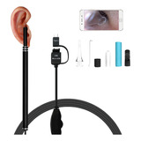 Cámara Endoscopio Limpiador Oídos Otoscopio Dental 6 Led's