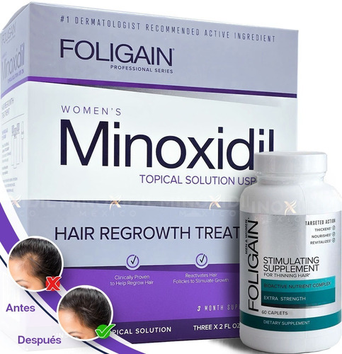 Minoxidil 2% Dama  + Foligain Tabs 60 Caps
