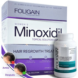 Minoxidil 2% Dama  + Foligain Tabs 60 Caps