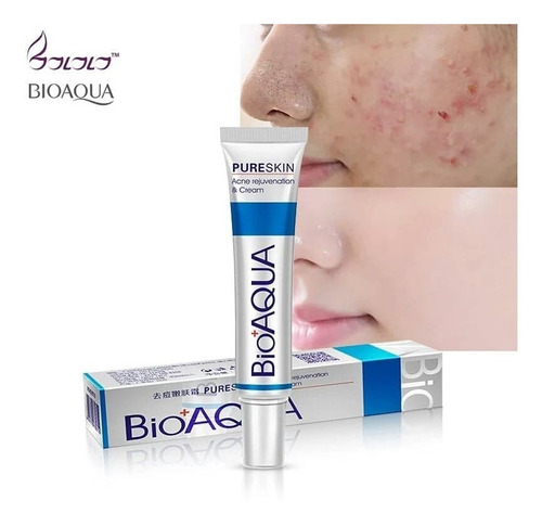 Bioaqua Crema Eliminación Acné Granos En Piel Cierra Poros