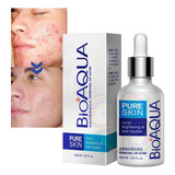 Bioaqua Serum Pure Skin Retira Acne Espinillas Regenera Full